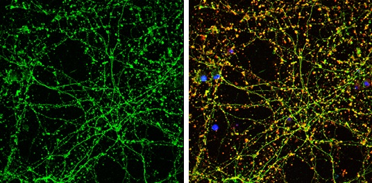 Immunocytochemistry/ Immunofluorescence - Anti-Serotonin transporter antibody (AB272912)
