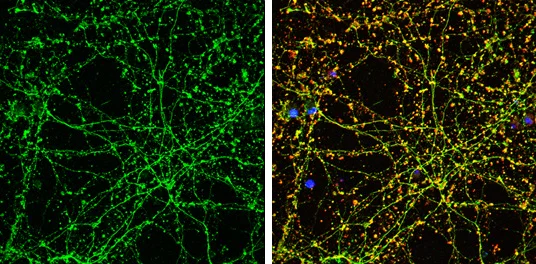 Immunocytochemistry/ Immunofluorescence - Anti-Serotonin transporter antibody (AB272912)