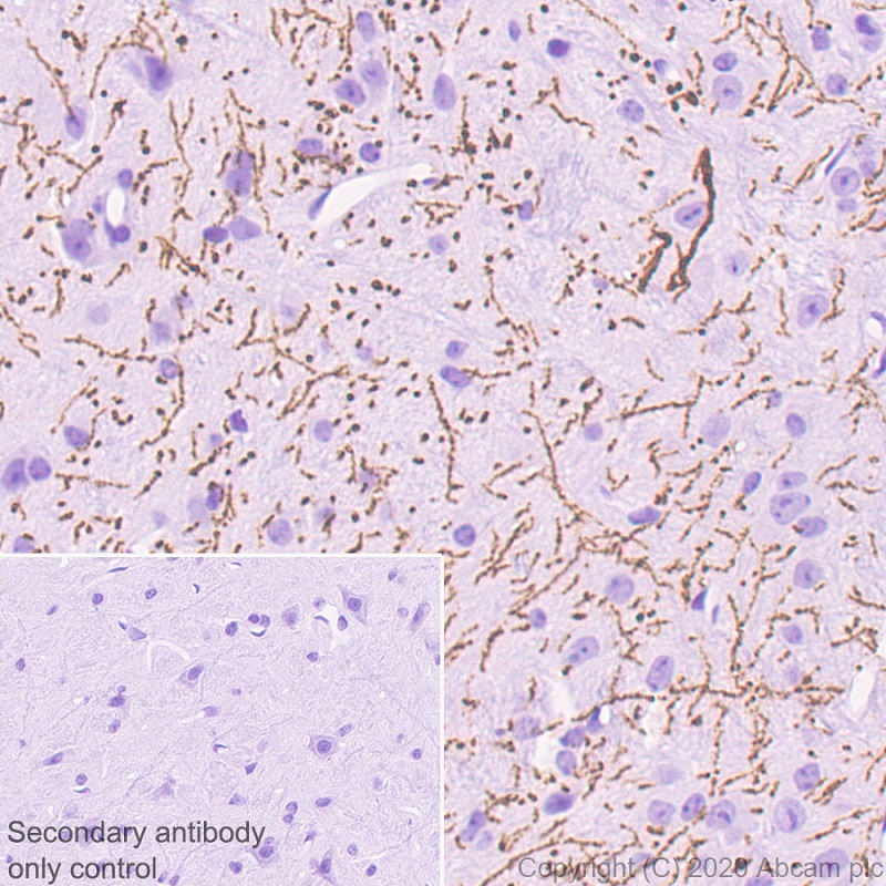 Immunohistochemistry (Formalin/PFA-fixed paraffin-embedded sections) - Anti-Serotonin transporter antibody [EPR23530-3] (AB254358), expandable thumbnail