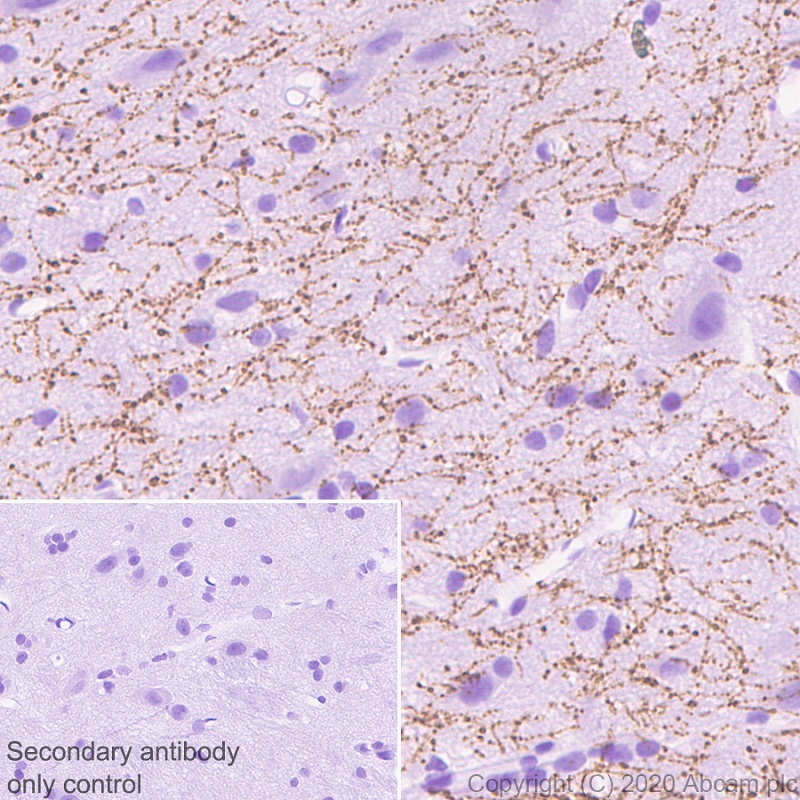 Immunohistochemistry (Formalin/PFA-fixed paraffin-embedded sections) - Anti-Serotonin transporter antibody [EPR23530-3] (ab254358), expandable thumbnail