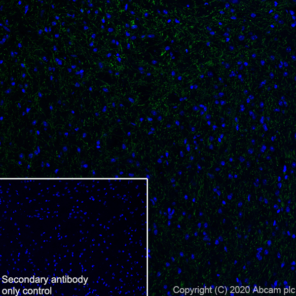 Immunohistochemistry (Frozen sections) - Anti-Serotonin transporter antibody [EPR23530-3] (AB254358), expandable thumbnail