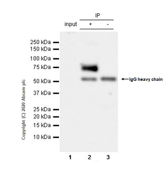 Immunoprecipitation - Anti-Serotonin transporter antibody [EPR23530-3] (AB254358), expandable thumbnail