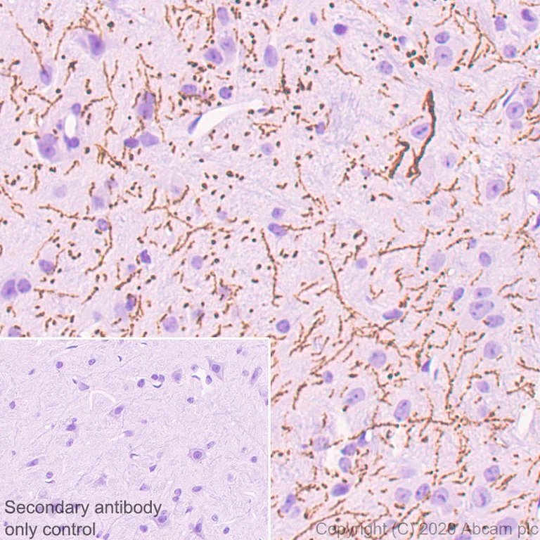 Immunohistochemistry (Formalin/PFA-fixed paraffin-embedded sections) - Anti-Serotonin transporter antibody [EPR23530-3] - BSA and Azide free (AB275094)
