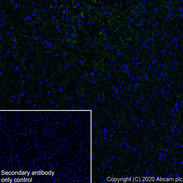 Immunohistochemistry (Frozen sections) - Anti-Serotonin transporter antibody [EPR23530-3] - BSA and Azide free (AB275094)