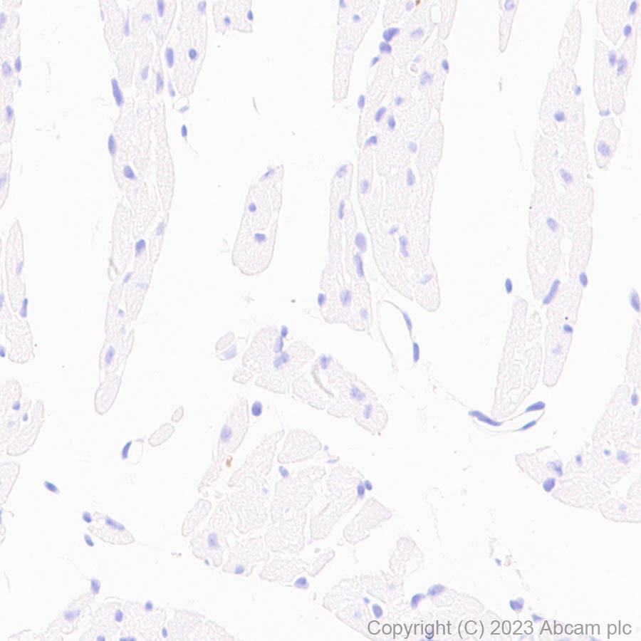 Immunohistochemistry (Formalin/PFA-fixed paraffin-embedded sections) - Anti-Serotonin transporter antibody [EPR26259-61] (ab308443), expandable thumbnail