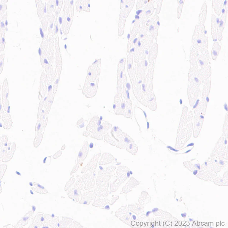 Immunohistochemistry (Formalin/PFA-fixed paraffin-embedded sections) - Anti-Serotonin transporter antibody [EPR26259-61] (AB308443)