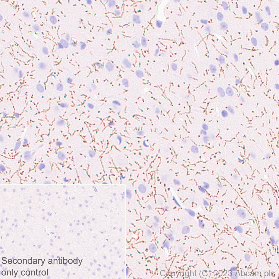 Immunohistochemistry (Formalin/PFA-fixed paraffin-embedded sections) - Anti-Serotonin transporter antibody [EPR26259-61] (ab308443), expandable thumbnail
