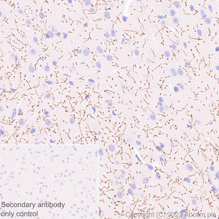 Immunohistochemistry (Formalin/PFA-fixed paraffin-embedded sections) - Anti-Serotonin transporter antibody [EPR26259-61] (AB308443)