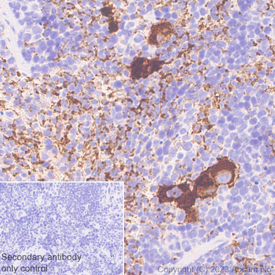 Immunohistochemistry (Formalin/PFA-fixed paraffin-embedded sections) - Anti-Serotonin transporter antibody [EPR26259-61] (ab308443), expandable thumbnail