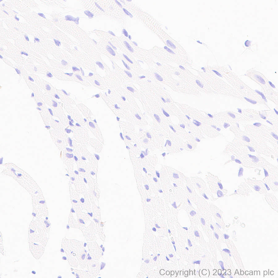 Immunohistochemistry (Formalin/PFA-fixed paraffin-embedded sections) - Anti-Serotonin transporter antibody [EPR26259-61] (ab308443), expandable thumbnail