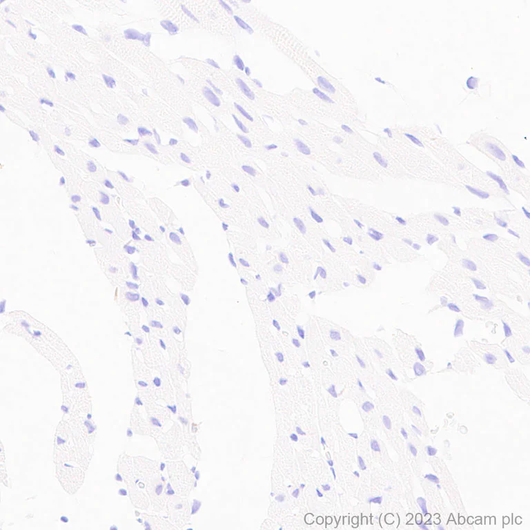 Immunohistochemistry (Formalin/PFA-fixed paraffin-embedded sections) - Anti-Serotonin transporter antibody [EPR26259-61] (AB308443)