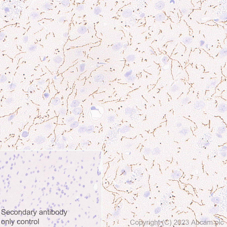 Immunohistochemistry (Formalin/PFA-fixed paraffin-embedded sections) - Anti-Serotonin transporter antibody [EPR26259-61] (ab308443), expandable thumbnail