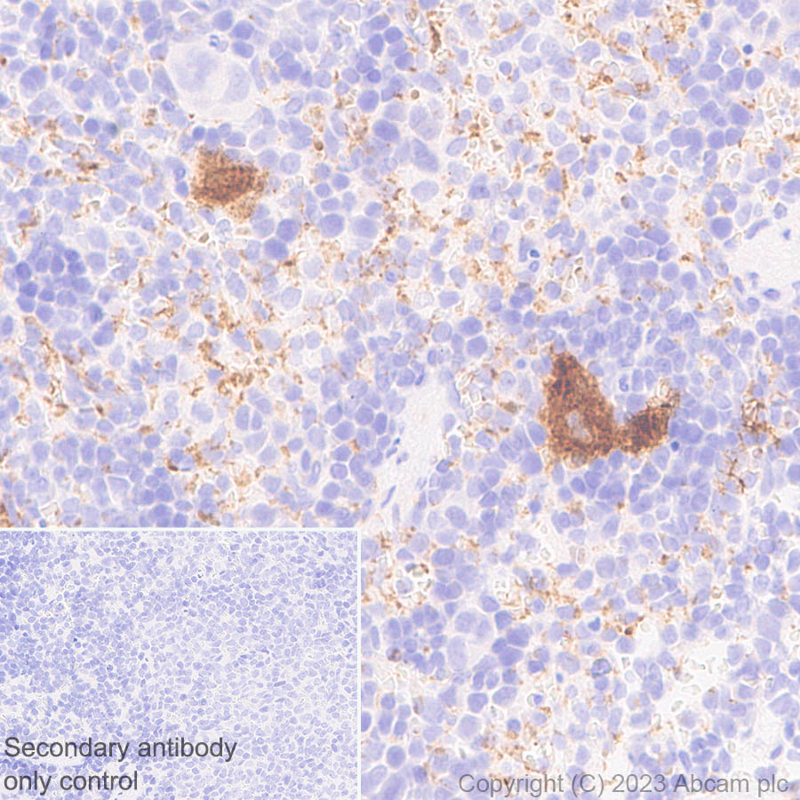 Immunohistochemistry (Formalin/PFA-fixed paraffin-embedded sections) - Anti-Serotonin transporter antibody [EPR26259-61] (ab308443), expandable thumbnail