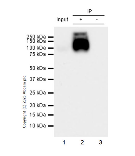 Immunoprecipitation - Anti-Serotonin transporter antibody [EPR26259-61] (ab308443), expandable thumbnail