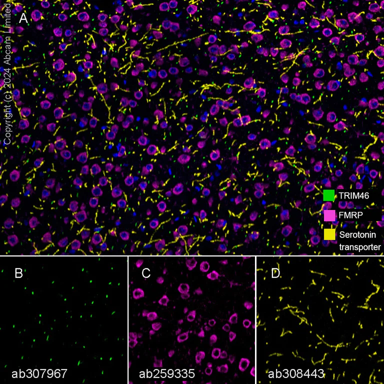Multiplex immunohistochemistry - Anti-Serotonin transporter antibody [EPR26259-61] (AB308443)