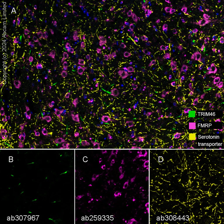 Multiplex immunohistochemistry - Anti-Serotonin transporter antibody [EPR26259-61] (AB308443)