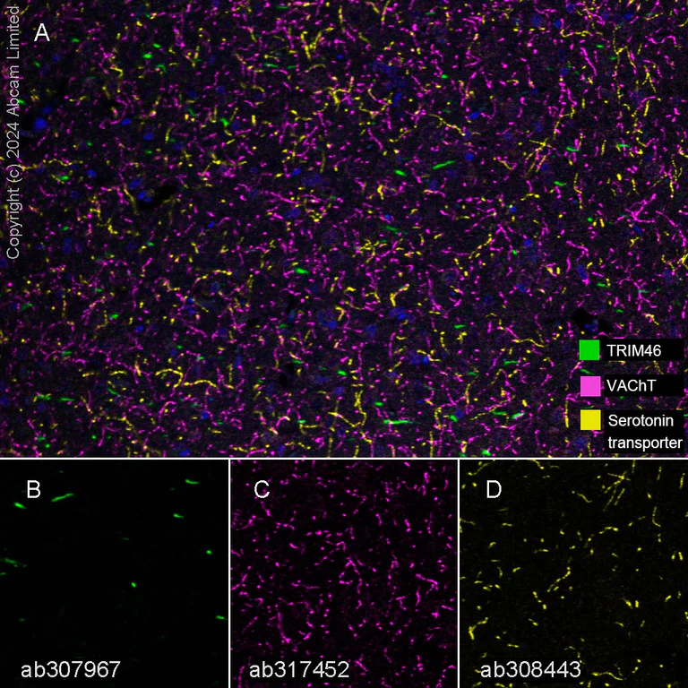 Multiplex immunohistochemistry - Anti-Serotonin transporter antibody [EPR26259-61] (AB308443)