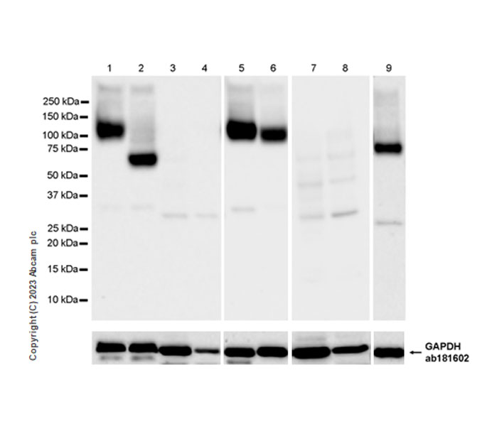 Western blot - Anti-Serotonin transporter antibody [EPR26259-61] (AB308443), expandable thumbnail