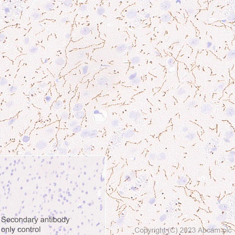 Immunohistochemistry (Formalin/PFA-fixed paraffin-embedded sections) - Anti-Serotonin transporter antibody [EPR26259-61] - BSA and Azide free (AB308444)