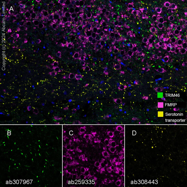 Multiplex immunohistochemistry - Anti-Serotonin transporter antibody [EPR26259-61] - BSA and Azide free (AB308444)