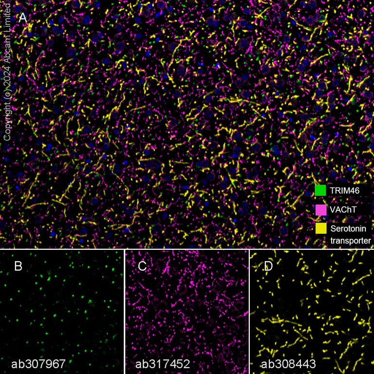 Multiplex immunohistochemistry - Anti-Serotonin transporter antibody [EPR26259-61] - BSA and Azide free (AB308444)