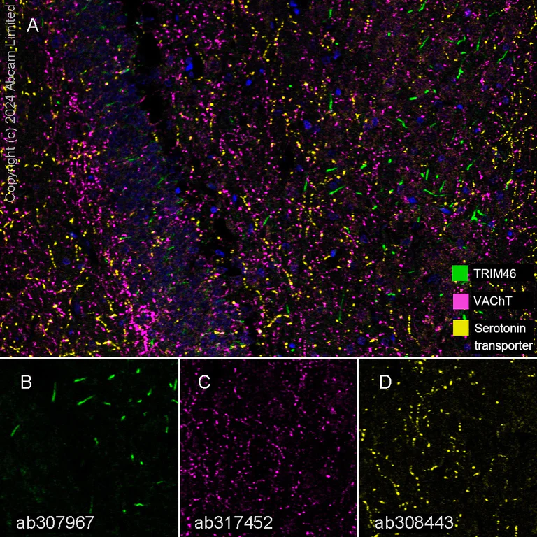 Multiplex immunohistochemistry - Anti-Serotonin transporter antibody [EPR26259-61] - BSA and Azide free (AB308444)