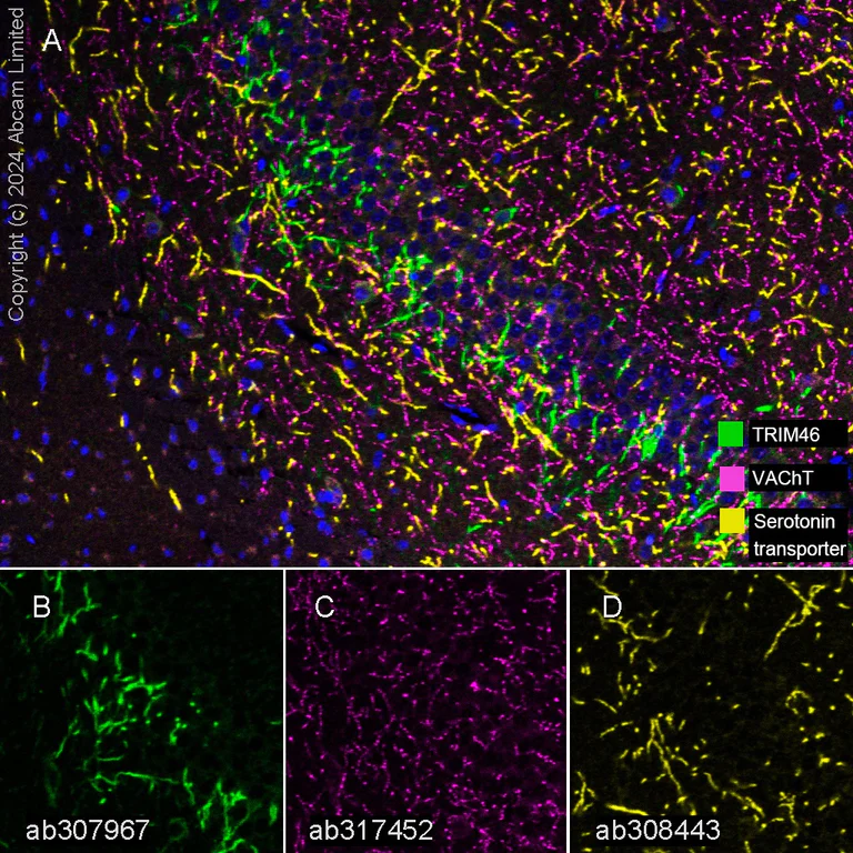 Multiplex immunohistochemistry - Anti-Serotonin transporter antibody [EPR26259-61] - BSA and Azide free (AB308444)