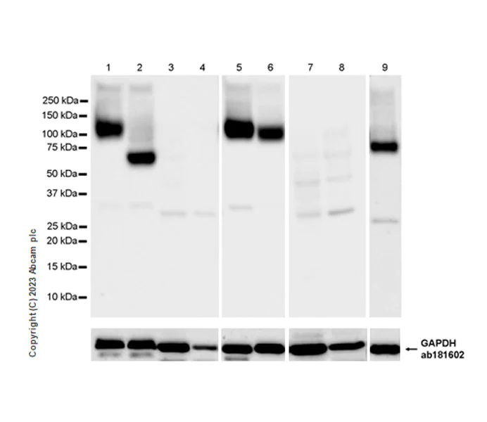 Western blot - Anti-Serotonin transporter antibody [EPR26259-61] - BSA and Azide free (AB308444)