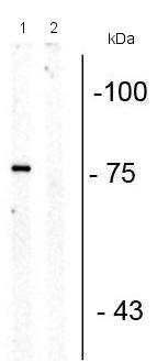 Western blot - Anti-Serotonin transporter (phospho T276) antibody (AB194262), expandable thumbnail