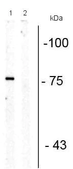 Western blot - Anti-Serotonin transporter (phospho T276) antibody (AB194262)