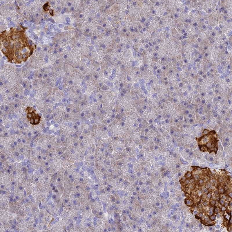 Immunohistochemistry (Formalin/PFA-fixed paraffin-embedded sections) - Anti-SERP1 antibody (AB254839), expandable thumbnail