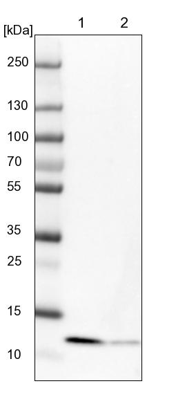 Western blot - Anti-SERP1 antibody (AB254839), expandable thumbnail