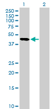Western blot - Anti-Serpin A5 antibody (AB172060), expandable thumbnail