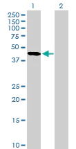 Western blot - Anti-Serpin A5 antibody (AB172060)