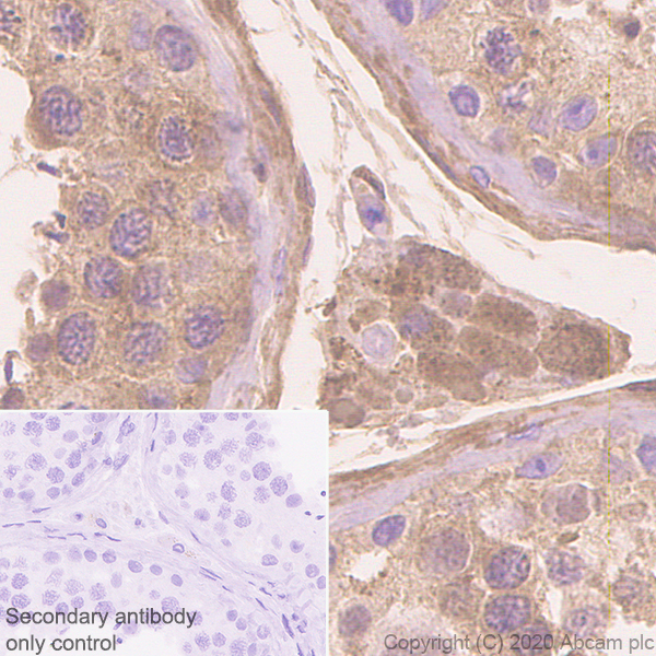 Immunohistochemistry (Formalin/PFA-fixed paraffin-embedded sections) - Anti-Serpin A5 antibody [EPR23337-112] (AB270451), expandable thumbnail
