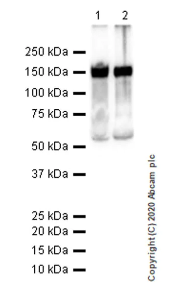 Western blot - Anti-Serpin A5 antibody [EPR23337-112] (AB270451)