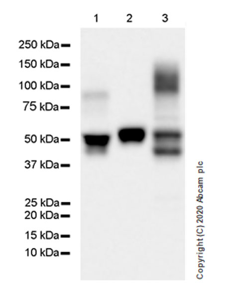 Western blot - Anti-Serpin A5 antibody [EPR23337-69] (AB270450), expandable thumbnail