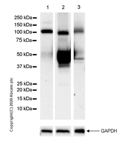 Western blot - Anti-Serpin A5 antibody [EPR23337-69] (AB270450), expandable thumbnail