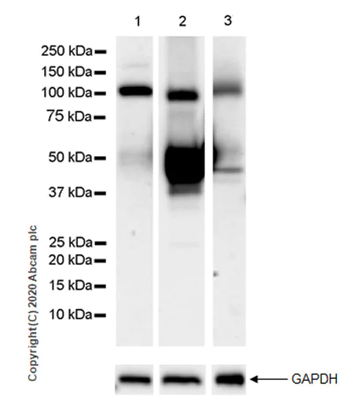 Western blot - Anti-Serpin A5 antibody [EPR23337-69] (AB270450)