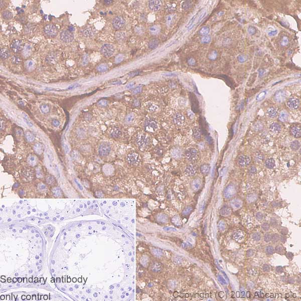 Immunohistochemistry (Formalin/PFA-fixed paraffin-embedded sections) - Anti-Serpin A5 antibody [EPR23337-69] - BSA and Azide free (AB272222), expandable thumbnail