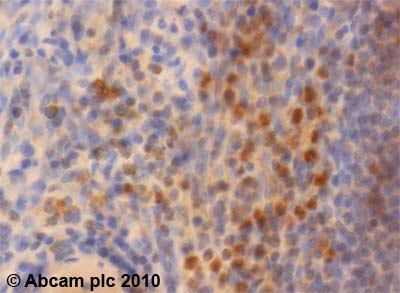 Immunohistochemistry (Formalin/PFA-fixed paraffin-embedded sections) - Anti-SERPINB1/PI2 antibody (AB47731), expandable thumbnail