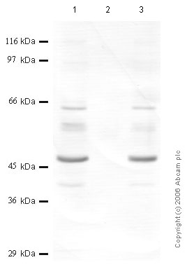 Western blot - Anti-SERPINB1/PI2 antibody (AB47731), expandable thumbnail