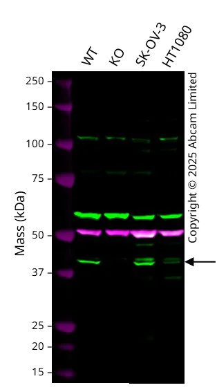 Western blot - Anti-SERPINB1/PI2 antibody - Membrane Vesicle Marker (AB195969)