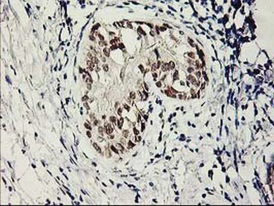 Immunohistochemistry (Formalin/PFA-fixed paraffin-embedded sections) - Anti-SERPINB13 antibody [OTI2B6] (AB236412)