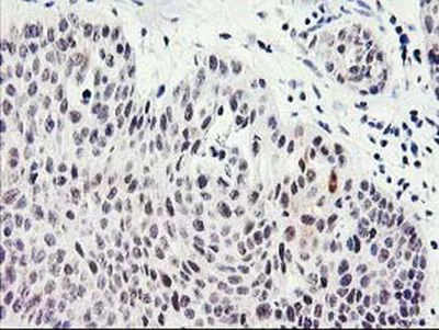 Immunohistochemistry (Formalin/PFA-fixed paraffin-embedded sections) - Anti-SERPINB13 antibody [OTI2B6] (AB236412)