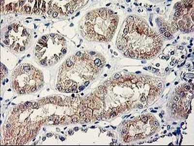 Immunohistochemistry (Formalin/PFA-fixed paraffin-embedded sections) - Anti-SERPINB13 antibody [OTI2B6] (AB236412)