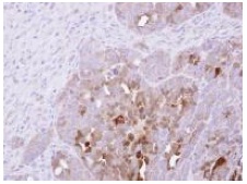 Immunohistochemistry (Formalin/PFA-fixed paraffin-embedded sections) - Anti-SerpinB2/PAI-2 antibody (AB137588)
