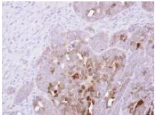 Immunohistochemistry (Formalin/PFA-fixed paraffin-embedded sections) - Anti-SerpinB2/PAI-2 antibody (AB137588)
