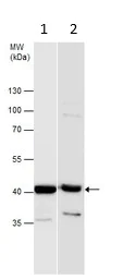 Western blot - Anti-SerpinB2/PAI-2 antibody (AB137588)