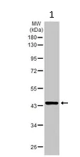 Western blot - Anti-SerpinB2/PAI-2 antibody (AB137588)